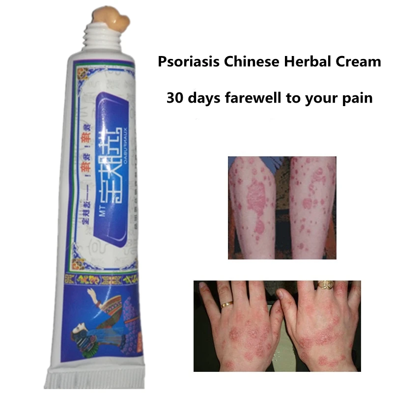 A psoríase Creme de Dermatite Eczematoid Eczema Pomada de Tratamento de Psoríase Escamosa Placa Corpo de Cuidados da Pele Creme 15g