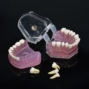 Dentista Macio Modelo de Fundação permitir retirar Dente Sugar puxe modelo de Ensino Dente Dentárias Removíveis Modelos  5