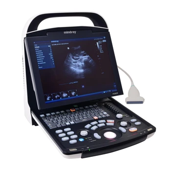 Médico ultra-som de Instrumentos de Diagnóstico por Imagem do Sistema digital Completo Mindray dp 30 máquina de ultra-som com Trole  5